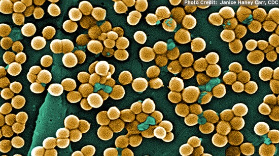 Fact sheet on Staphylococcus - Examining Food